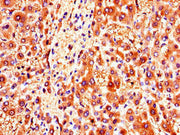 Immunohistochemistry of paraffin-embedded human liver tissue using CSB-PA026504LA01HU at dilution of 1:100