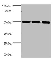 Western blot All lanes: ZMYND10 antibody at 8ug/ml Lane 1: A549 whole cell lysate Lane 2: Mouse kidney tissue Lane 3: Mouse skeletal muscle tissue Secondary Goat polyclonal to rabbit IgG at 1/10000 dilution Predicted band size: 51, 50 kDa Observed...