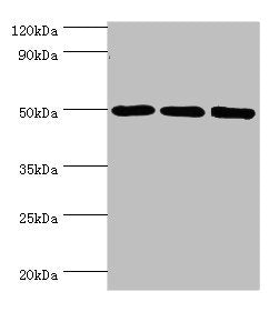 Western blot All lanes: ZMYND10 antibody at 8ug/ml Lane 1: A549 whole cell lysate Lane 2: Mouse kidney tissue Lane 3: Mouse skeletal muscle tissue Secondary Goat polyclonal to rabbit IgG at 1/10000 dilution Predicted band size: 51, 50 kDa Observed...