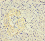 Immunohistochemistry of paraffin-embedded human pancreatic tissue using CSB-PA026523LA01HU at dilution of 1:100