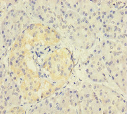 Immunohistochemistry of paraffin-embedded human pancreatic tissue using CSB-PA026523LA01HU at dilution of 1:100