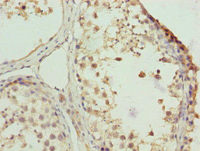 Immunohistochemistry of paraffin-embedded human testis tissue using CSB-PA026530LA01HU at dilution of 1:100