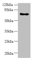 Western blot All lanes: ZNF133 antibody at 5µg/ml + Hela whole cell lysate Secondary Goat polyclonal to rabbit IgG at 1/10000 dilution Predicted band size: 74, 63, 67 kDa Observed band size: 74 kDa