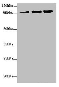 Western blot All lanes: ZNF148 antibody at 1.06µg/ml Lane 1: A375 whole cell lysate Lane 2: HepG2 whole cell lysate Lane 3: 293T whole cell lysate Secondary Goat polyclonal to rabbit IgG at 1/10000 dilution Predicted band size: 89, 15 kDa Observed...