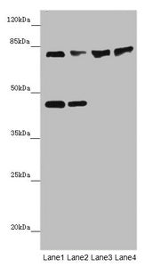 Western blot All lanes: ZNF169antibody at 2ug/ml Lane 1: HepG2 whole cell lysate Lane 2: Hela whole cell lysate Lane 3: Mouse liver tissue Lane 4: Mouse kidney tissue Secondary Goat polyclonal to rabbit IgG at 1/10000 dilution Predicted band size:...