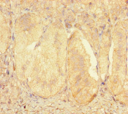 Immunohistochemistry of paraffin-embedded human adrenal gland tissue using CSB-PA026556LA01HU at dilution of 1:100