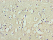 Immunohistochemistry of paraffin-embedded human brain tissue using CSB-PA026558LA01HU at dilution of 1:100