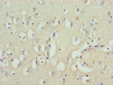 Immunohistochemistry of paraffin-embedded human brain tissue using CSB-PA026558LA01HU at dilution of 1:100