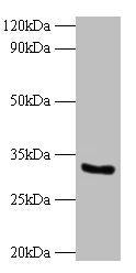 Western blot All lanes: CYB5R3 antibody at 2µg/ml + 293T whole cell lysate Secondary Goat polyclonal to rabbit IgG at 1/10000 dilution Predicted band size: 35, 32, 39 kDa Observed band size: 32 kDa