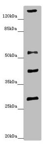 Western blot All lanes: ZSCAN26antibody at 1.34ug/ml + Mouse brain tissue Secondary Goat polyclonal to rabbit IgG at 1/10000 dilution Predicted band size: 56, 38 kDa Observed band size: 56, 29, 40, 160 kDa