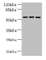 Western blot All lanes: ZNF19 antibody at 4µg/ml Lane 1: Mouse liver tissue Lane 2: MDA-MB-231 whole cell lysate Lane 3: HepG2 whole cell lysate Secondary Goat polyclonal to rabbit IgG at 1/10000 dilution Predicted band size: 53, 52 kDa Observed b...
