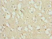 Immunohistochemistry of paraffin-embedded human brain tissue using CSB-PA026570ESR1HU at dilution of 1:100