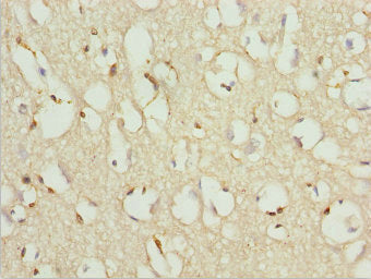 Immunohistochemistry of paraffin-embedded human brain tissue using CSB-PA026570ESR1HU at dilution of 1:100