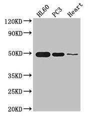 Western Blot Positive WB detected in: HL60 whole cell lysate, PC-3 whole cell lysate, Mouse heart tissue All lanes: ZNF2 antibody at 2.7ug/ml Secondary Goat polyclonal to rabbit IgG at 1/50000 dilution Predicted band size: 49, 45 kDa Observed band...