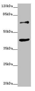 Western blot All lanes: ZNF20 antibody at 2.53ug/ml + MCF-7 whole cell lysate Secondary Goat polyclonal to rabbit IgG at 1/10000 dilution Predicted band size: 62 kDa Observed band size: 62, 40 kDa