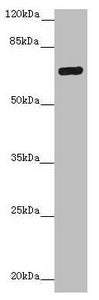 Western blot All lanes: ZNF20 antibody at 2.99ug/ml + Mouse kidney tissue Secondary Goat polyclonal to rabbit IgG at 1/10000 dilution Predicted band size: 62 kDa Observed band size: 62 kDa