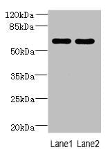 Western blot All lanes: ZNF215 antibody at 3µg/ml Lane 1: Hela whole cell lysate Lane 2: A431 whole cell lysate Secondary Goat polyclonal to rabbit IgG at 1/10000 dilution Predicted band size: 61, 36 kDa Observed band size: 61 kDa