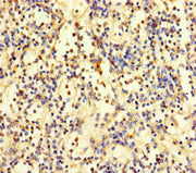 Immunohistochemistry of paraffin-embedded human spleen tissue using CSB-PA026589LA01HU at dilution of 1:100