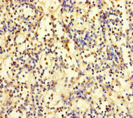 Immunohistochemistry of paraffin-embedded human spleen tissue using CSB-PA026589LA01HU at dilution of 1:100
