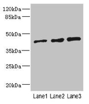 Western blot All lanes: ZNF24 antibody at 2.88µg/ml Lane 1: 293T whole cell lysate Lane 2: Jurkat whole cell lysate Lane 3: Hela whole cell lysate Secondary Goat polyclonal to rabbit IgG at 1/10000 dilution Predicted band size: 43, 23 kDa Observed...