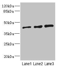 Western blot All lanes: ZNF24 antibody at 2.88µg/ml Lane 1: 293T whole cell lysate Lane 2: Jurkat whole cell lysate Lane 3: Hela whole cell lysate Secondary Goat polyclonal to rabbit IgG at 1/10000 dilution Predicted band size: 43, 23 kDa Observed...