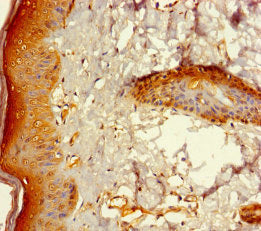 Immunohistochemistry of paraffin-embedded human skin tissue using CSB-PA026620LA01HU at dilution of 1:100