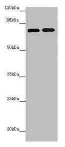 Western blot All lanes: ZNF264 antibody at 2.07µg/ml Lane 1: Jurkat whole cell lysate Lane 2: 293T whole cell lysate Secondary Goat polyclonal to rabbit IgG at 1/10000 dilution Predicted band size: 71 kDa Observed band size: 71 kDa