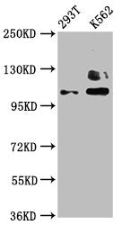 Western Blot Positive WB detected in: 293T whole cell lysate, K562 whole cell lysate All lanes: ZNF268 antibody at 4µg/ml Secondary Goat polyclonal to rabbit IgG at 1/50000 dilution Predicted band size: 109, 90, 10, 12, 16, 6, 13 kDa Observed band...