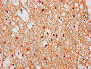 IHC image of CSB-PA026638LA01HU diluted at 1:400 and staining in paraffin-embedded human brain tissue performed on a Leica BondTM system. After dewaxing and hydration, antigen retrieval was mediated by high pressure in a citrate buffer (pH 6.0). S...