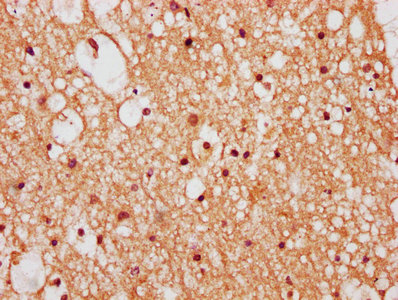 IHC image of CSB-PA026638LA01HU diluted at 1:400 and staining in paraffin-embedded human brain tissue performed on a Leica BondTM system. After dewaxing and hydration, antigen retrieval was mediated by high pressure in a citrate buffer (pH 6.0). S...