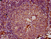 IHC image of CSB-PA026646LA01HU diluted at 1:100 and staining in paraffin-embedded human tonsil tissue performed on a Leica BondTM system. After dewaxing and hydration, antigen retrieval was mediated by high pressure in a citrate buffer (pH 6.0)....