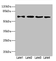 Western blot All lanes: ZNF324antibody at 1.57ug/ml Lane 1: A549 whole cell lysate Lane 2: 293T whole cell lysate Lane 3: MCF-7 whole cell lysate Lane 4: Jurkat whole cell lysate Secondary Goat polyclonal to rabbit IgG at 1/10000 dilution Predicte...