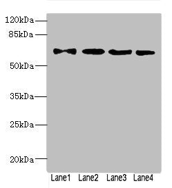 Western blot All lanes: ZNF324antibody at 1.57ug/ml Lane 1: A549 whole cell lysate Lane 2: 293T whole cell lysate Lane 3: MCF-7 whole cell lysate Lane 4: Jurkat whole cell lysate Secondary Goat polyclonal to rabbit IgG at 1/10000 dilution Predicte...