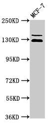 Western Blot Positive WB detected in: MCF-7 whole cell lysate All lanes: ZNF335 antibody at 3.5µg/ml Secondary Goat polyclonal to rabbit IgG at 1/50000 dilution Predicted band size: 145, 130 kDa Observed band size: 145, 130 kDa