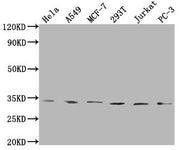 Western Blot Positive WB detected in: Hela whole cell lysate, A549 whole cell lysate, MCF-7 whole cell lysate, 293T whole cell lysate, Jurkat whole cell lysate, PC-3 whole cell lysate All lanes: ZNF346 antibody at 1:1000 Secondary Goat polyclonal...