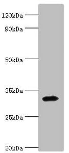 Western blot All lanes: Zinc finger protein 346 antibody at 3ug/ml + Mouse brain tissue Secondary Goat polyclonal to rabbit IgG at 1/10000 dilution Predicted band size: 33, 36, 30 kDa Observed band size: 33 kDa