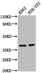 Western Blot Positive WB detected in: K562 whole cell lysate, NIH/3T3 whole cell lysate All lanes: ZNF367 antibody at 6µg/ml Secondary Goat polyclonal to rabbit IgG at 1/50000 dilution Predicted band size: 39, 33 kDa Observed band size: 39 kDa