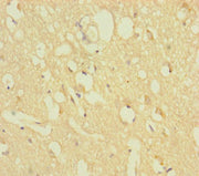 Immunohistochemistry of paraffin-embedded human brain tissue using CSB-PA026719LA01HU at dilution of 1:100