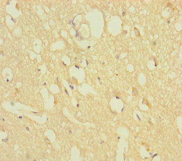 Immunohistochemistry of paraffin-embedded human brain tissue using CSB-PA026719LA01HU at dilution of 1:100