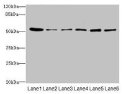 Western blot All lanes: ZNF398 antibody at 3µg/ml Lane 1: 293T whole cell lysate Lane 2: Hela whole cell lysate Lane 3: HepG2 whole cell lysate Lane 4: Jurkat whole cell lysate Lane 5: Caco-2 whole cell lysate Lane 6: A549 whole cell lysate Second...