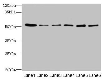 Western blot All lanes: ZNF398 antibody at 3µg/ml Lane 1: 293T whole cell lysate Lane 2: Hela whole cell lysate Lane 3: HepG2 whole cell lysate Lane 4: Jurkat whole cell lysate Lane 5: Caco-2 whole cell lysate Lane 6: A549 whole cell lysate Second...