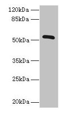 Western blot All lanes: ZNF410 antibody at 3µg/ml + Mouse brain tissue Secondary Goat polyclonal to rabbit IgG at 1/10000 dilution Predicted band size: 53, 30, 48, 45, 56 kDa Observed band size: 53 kDa