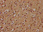 IHC image of CSB-PA026737LA01HU diluted at 1:300 and staining in paraffin-embedded human brain tissue performed on a Leica BondTM system. After dewaxing and hydration, antigen retrieval was mediated by high pressure in a citrate buffer (pH 6.0). S...