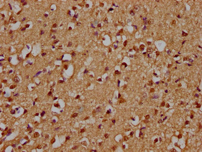 IHC image of CSB-PA026737LA01HU diluted at 1:300 and staining in paraffin-embedded human brain tissue performed on a Leica BondTM system. After dewaxing and hydration, antigen retrieval was mediated by high pressure in a citrate buffer (pH 6.0). S...
