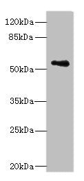 Western blot All lanes: ZSCAN32 antibody at 1µg/ml + MCF-7 whole cell lysate Secondary Goat polyclonal to rabbit IgG at 1/10000 dilution Predicted band size: 79, 55, 47 kDa Observed band size: 55 kDa