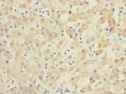Immunohistochemistry of paraffin-embedded human liver tissue using CSB-PA026768LA01HU at dilution of 1:100