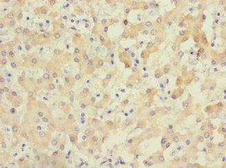 Immunohistochemistry of paraffin-embedded human liver tissue using CSB-PA026768LA01HU at dilution of 1:100
