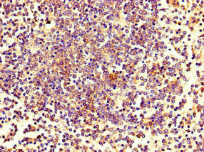 Immunohistochemistry of paraffin-embedded human spleen tissue using CSB-PA026781LA01HU at dilution of 1:100