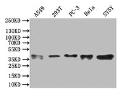 Western Blot Positive WB detected in: A549 whole cell lysate,293T whole cell lysate,PC-3 whole cell lysate,Hela whole cell lysate,SY5Y whole cell lysate All lanes: ZNF488 antibody at 1:1000 Secondary Goat polyclonal to rabbit IgG at 1/50000 diluti...