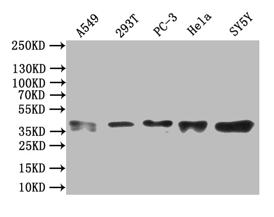 Western Blot Positive WB detected in: A549 whole cell lysate,293T whole cell lysate,PC-3 whole cell lysate,Hela whole cell lysate,SY5Y whole cell lysate All lanes: ZNF488 antibody at 1:1000 Secondary Goat polyclonal to rabbit IgG at 1/50000 diluti...